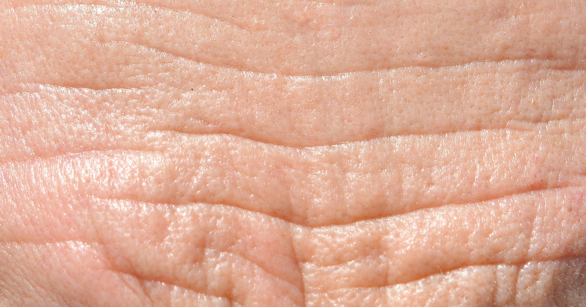 What are ceramides — skin barrier lipids that lock in moisture and protect against environmental damage