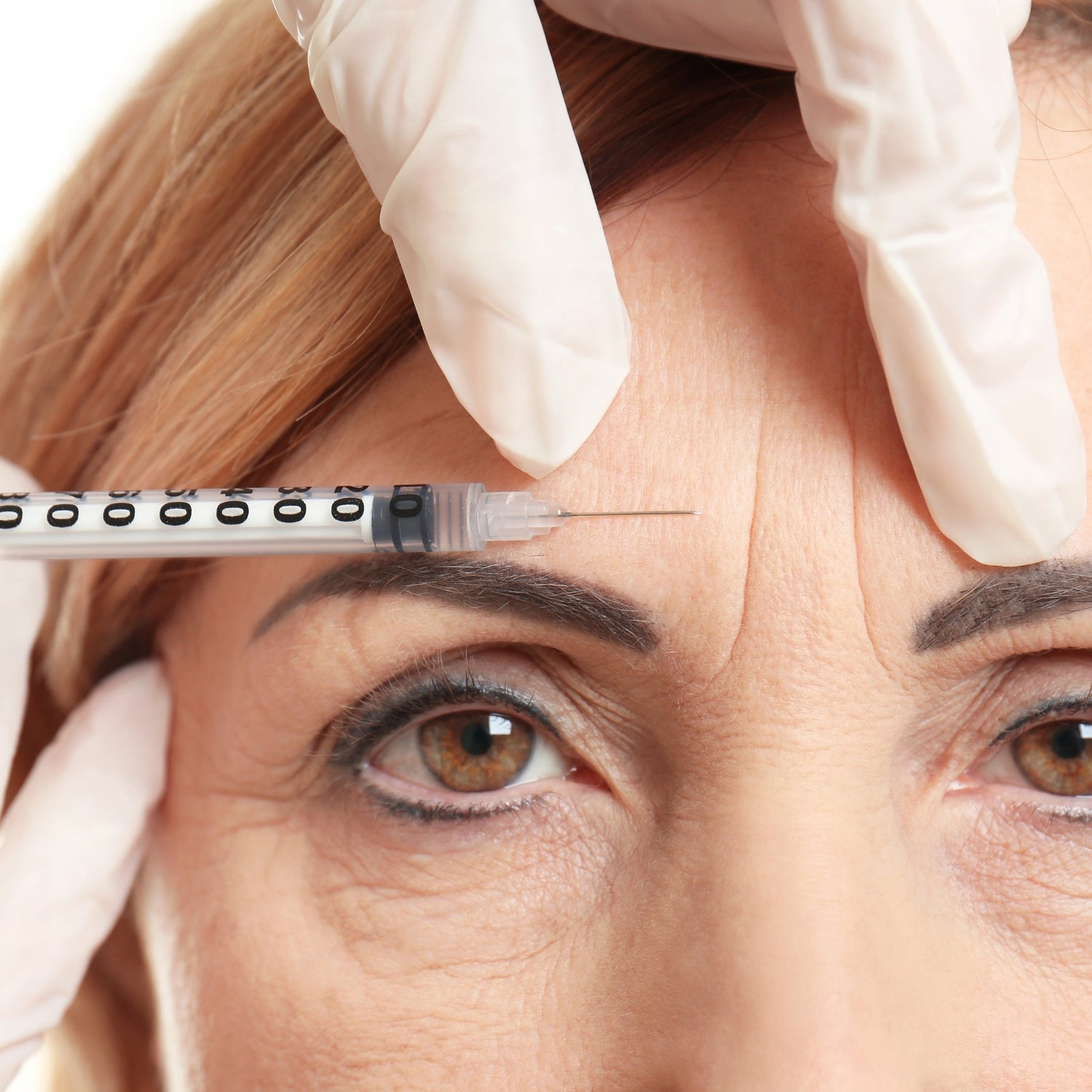 Looking for a Botox Alternative in your 40's ?
